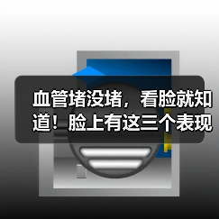 血管堵没堵，看脸就知道！脸上有这三个表现的人，警惕这种致命性疾病 来源：互联网 2025-08-15（图3）